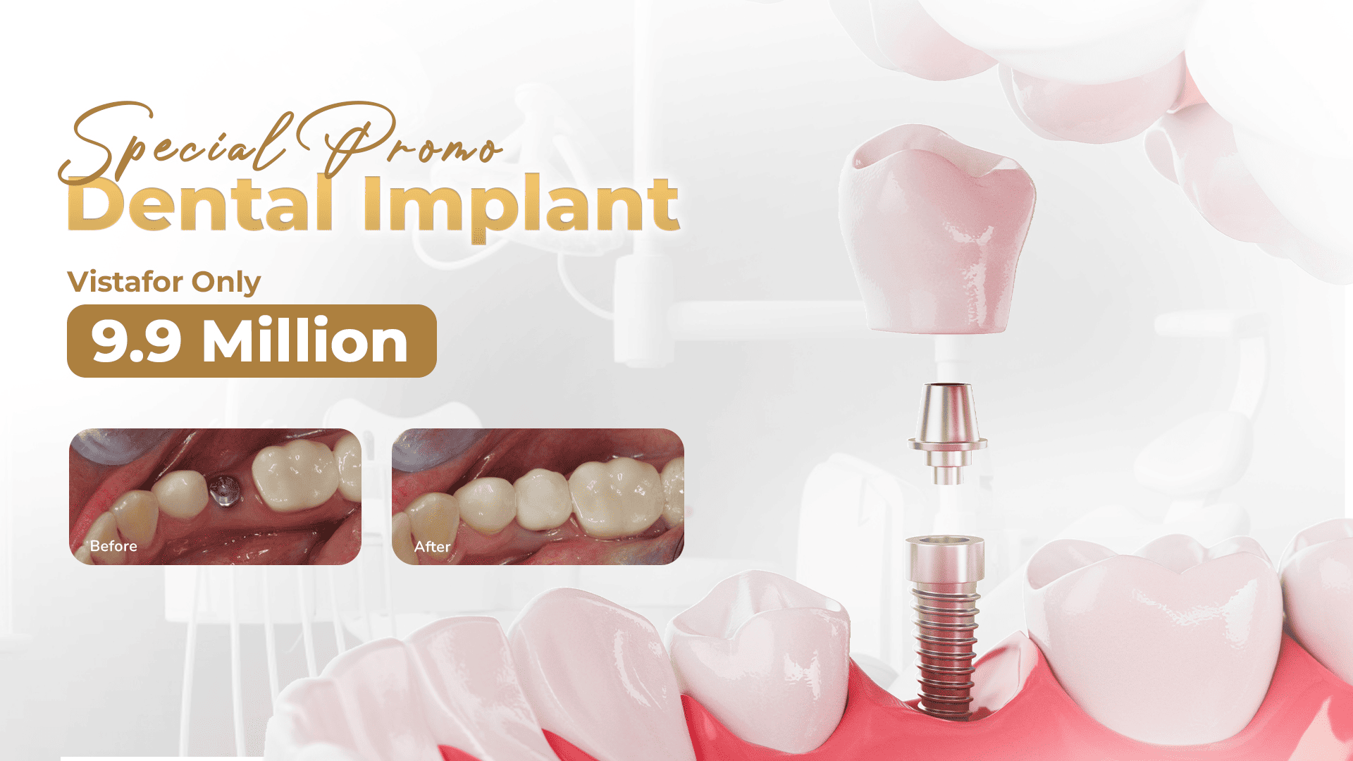 Smile Lab Hero Slide 2