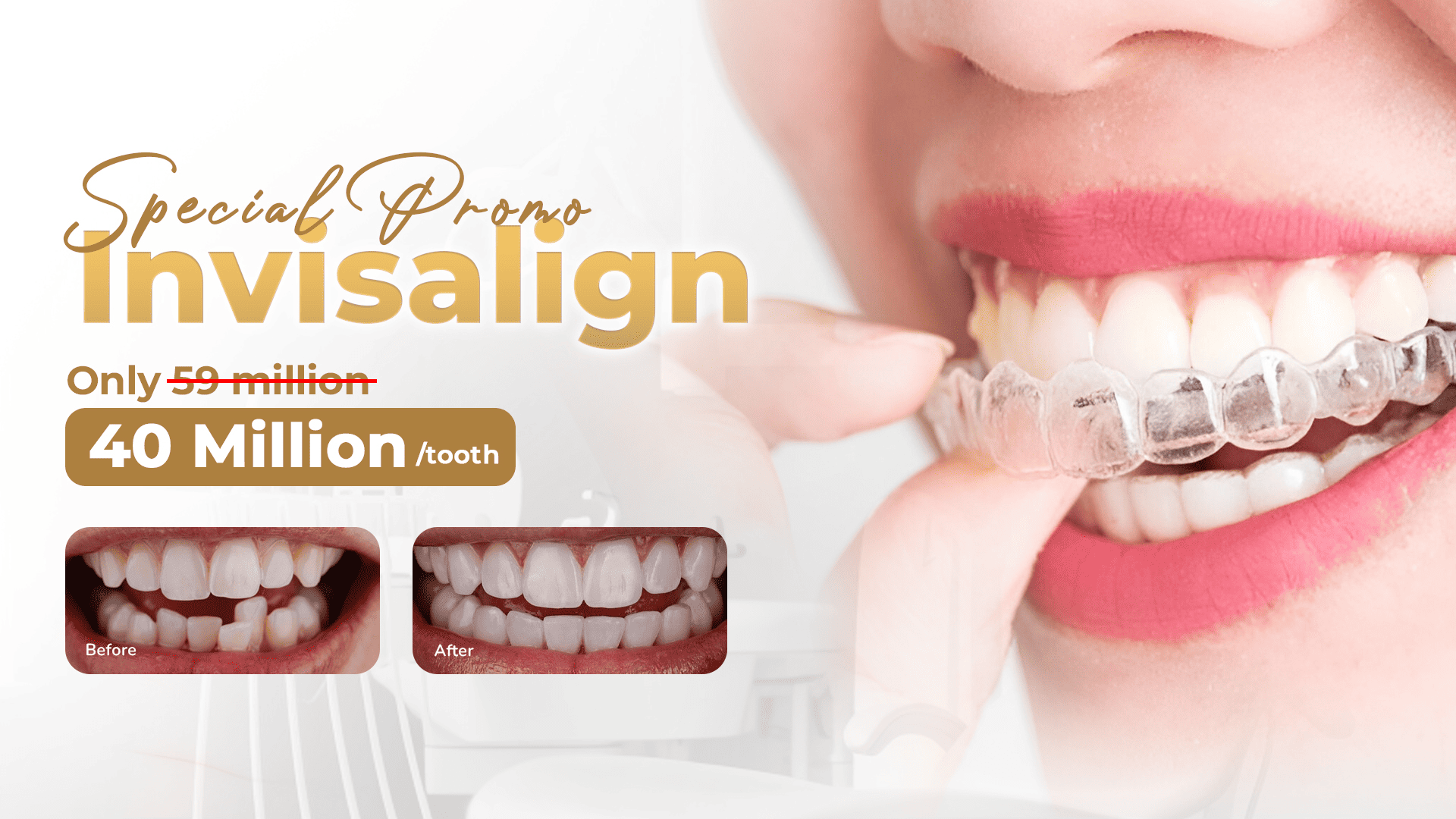 Smile Lab Hero Slide 3